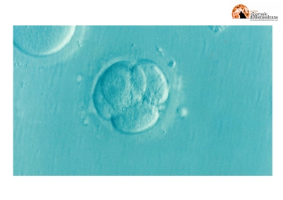 Scambio di embrioni in vitro, donna partorisce figlia di sconosciuti