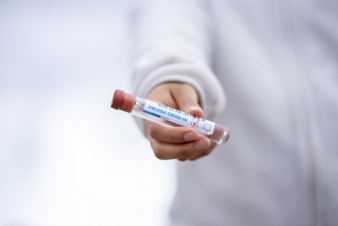 Coronavirus, in Italia 85 morti in più.