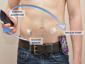 Il sistema controllato da smartphone