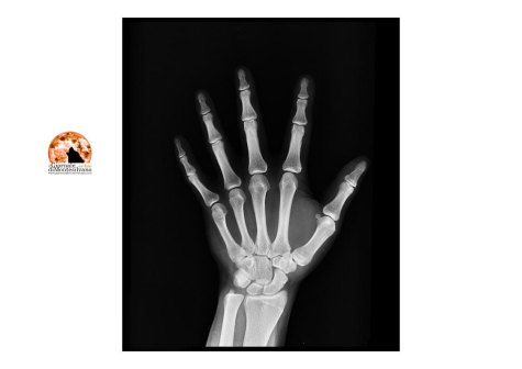 Abruzzo/Sanità: servizi digitali, in arrivo sull’app anche le immagini diagnostiche