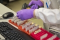 Coronavirus, dati in Abruzzo:  35 nuovi casi. 123 decessi totali.