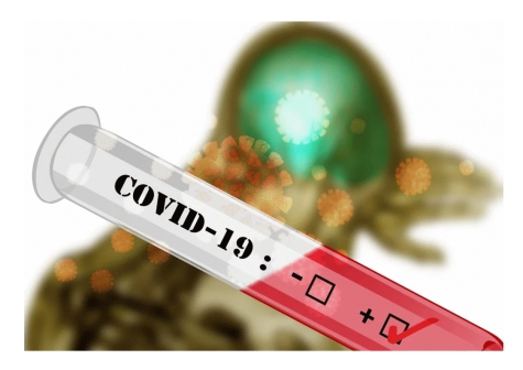 Covid19. Arcuri: Vaccino in Italia a fine Gennaio