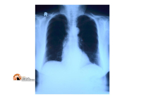 Abruzzo/Sanità, arriva la piattaforma VNA: immagini radiologiche regionali centralizzate e condivise