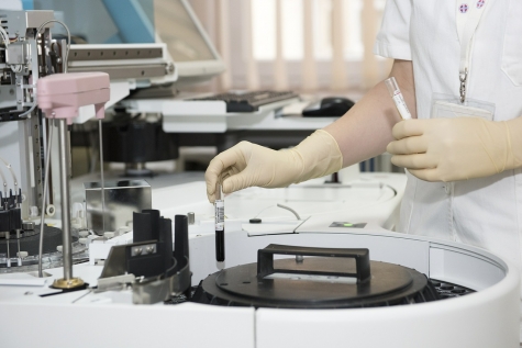 Sindrome Metabolica, fattore di rischio per la insorgenza di adenomi e cancro del colon.