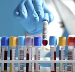 Hiv, epatite B e C, sifilide, "Fai il test anche tu"