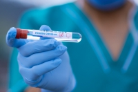 Coronavirus, altri 172 morti